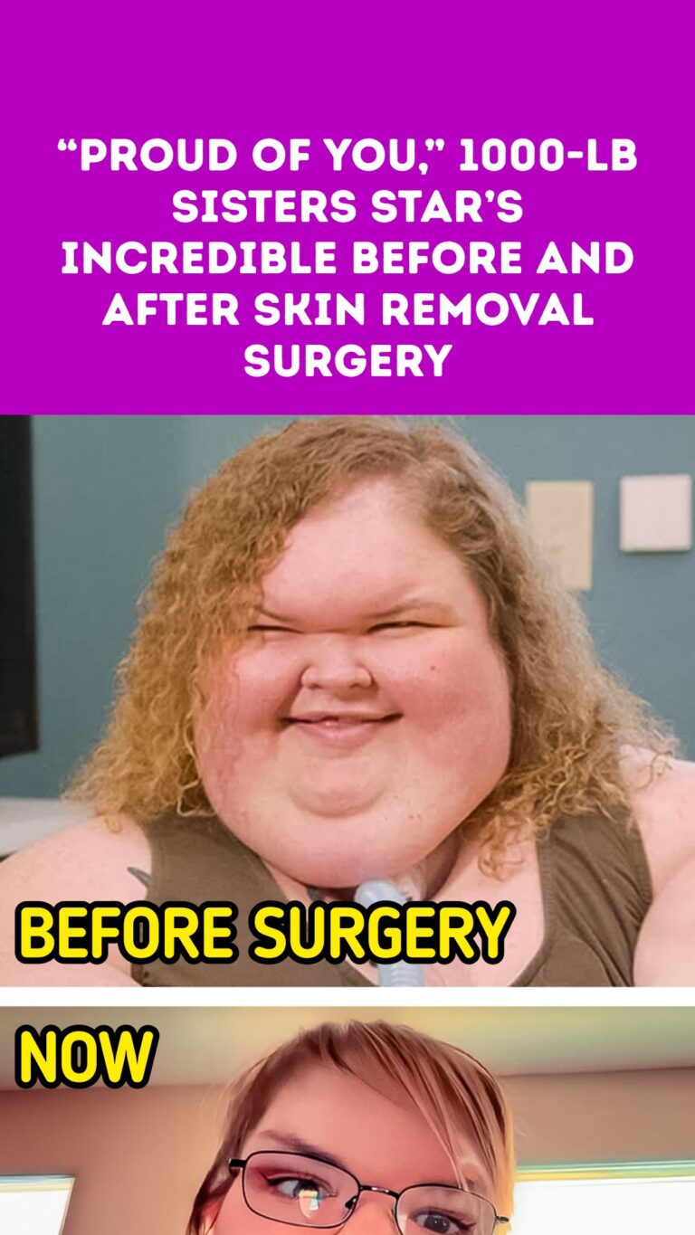“Proud of You,” 1000-lb Sisters Star’s Incredible Before and After Skin Removal Surgery