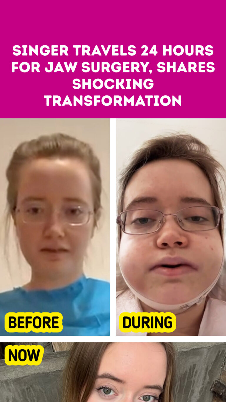 Singer Travels 24 Hours for Jaw Surgery, Shares Shocking Transformation