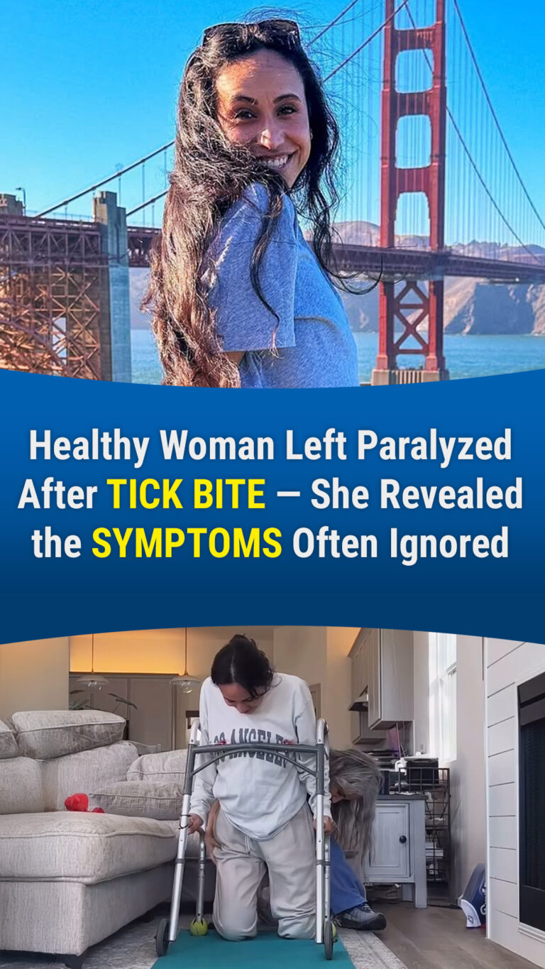 After a Tick Bite, a Fitness Influencer Experienced Symptoms Often Ignored – Now She’s Partially Paralyzed