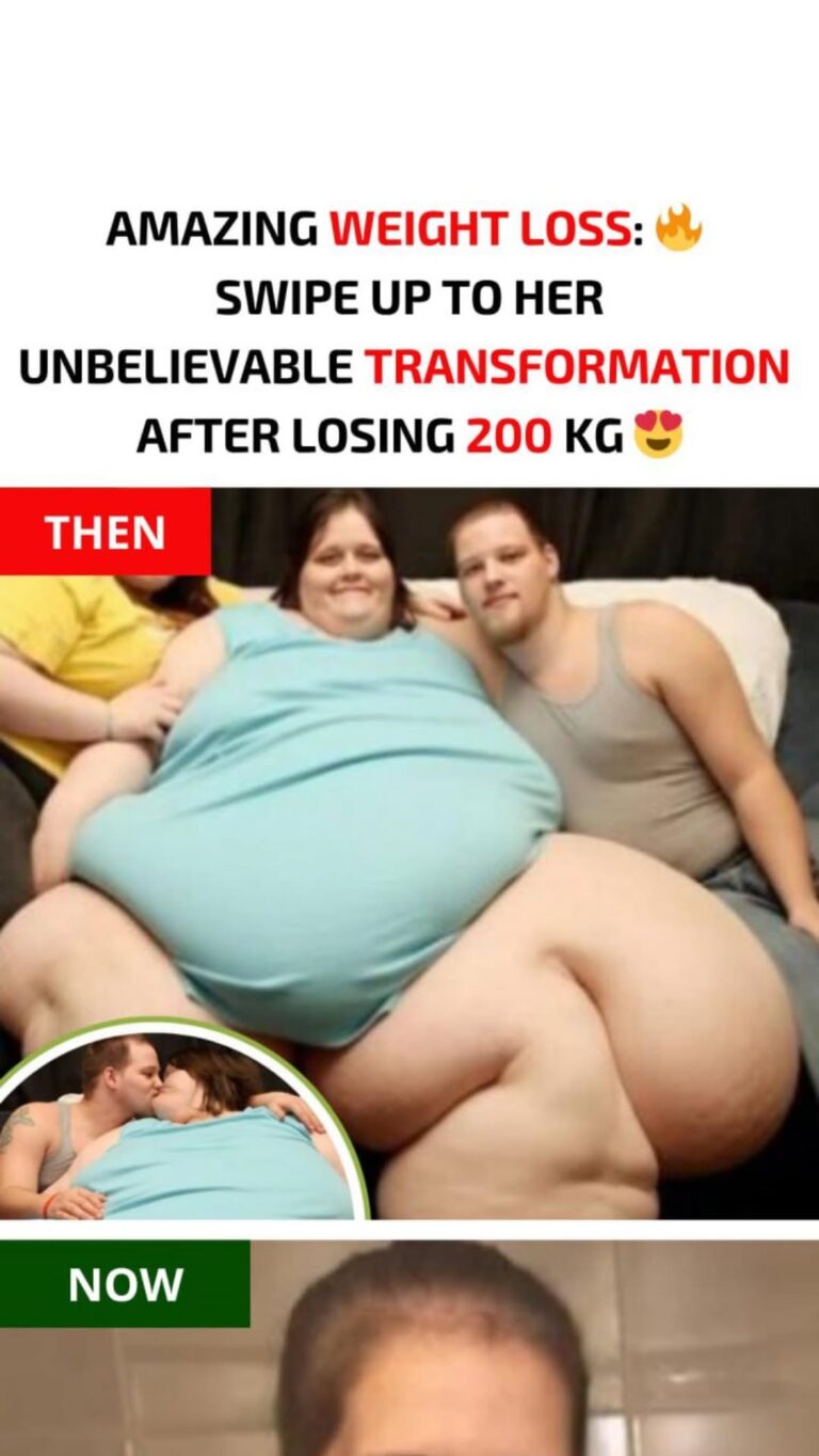 Woman Once Weighed 350kg Because Of That But Lost 200kg: Here’s What She Looks Like Now