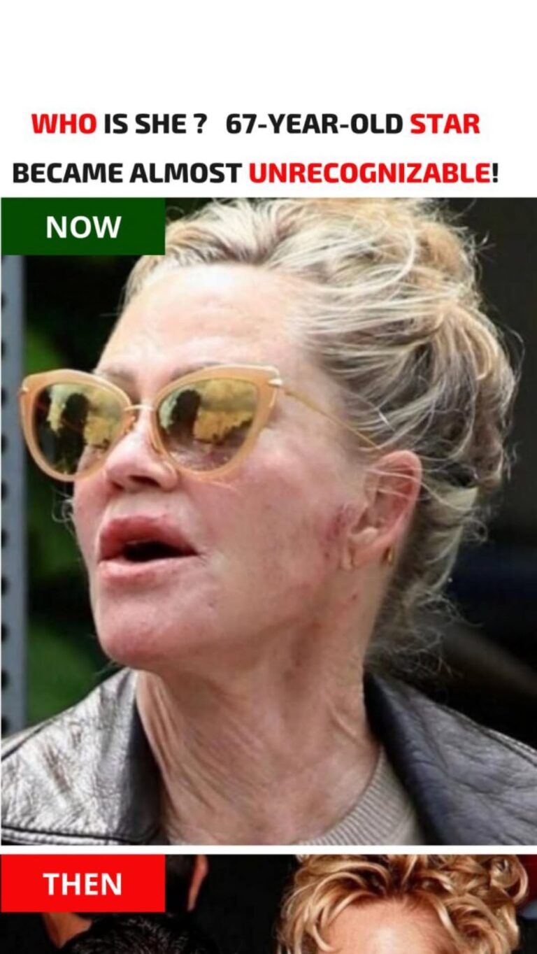 😱Fans were shocked when a paparazzi photo revealed the 67-year old, who was almost unrecognizable.