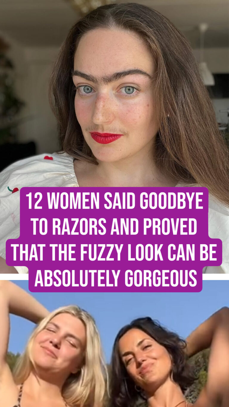 12 Women Said Goodbye to Razors and Proved That the Fuzzy Look Can Be Absolutely Gorgeous
