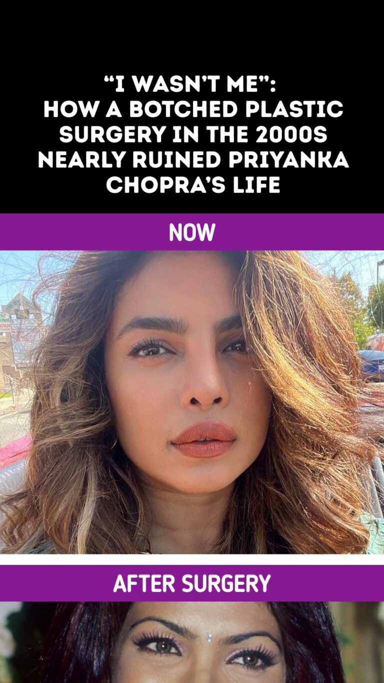 “I Wasn’t Me”: How a Botched Plastic Surgery in the 2000s Nearly Ruined Priyanka Chopra’s Life