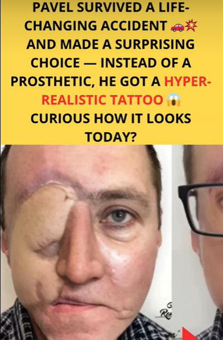 This artist tattoos the face of a man who was disfigured after a tragic accident.