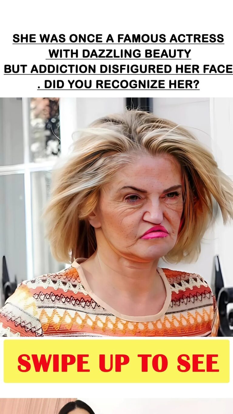 She was once a famous actress with dazzling beauty, but addiction disfigured her face