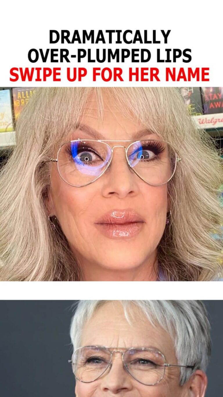 Hollywood Legend Surprises Fans With Dramatically Over-Plumped Lips and Bold New Look !