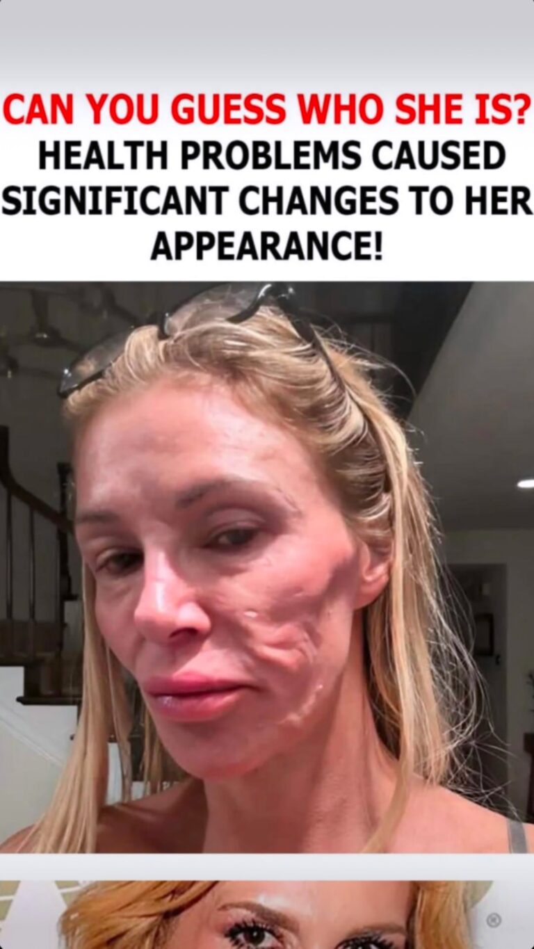Can you recognize her? Health issues caused significant changes to her appearance