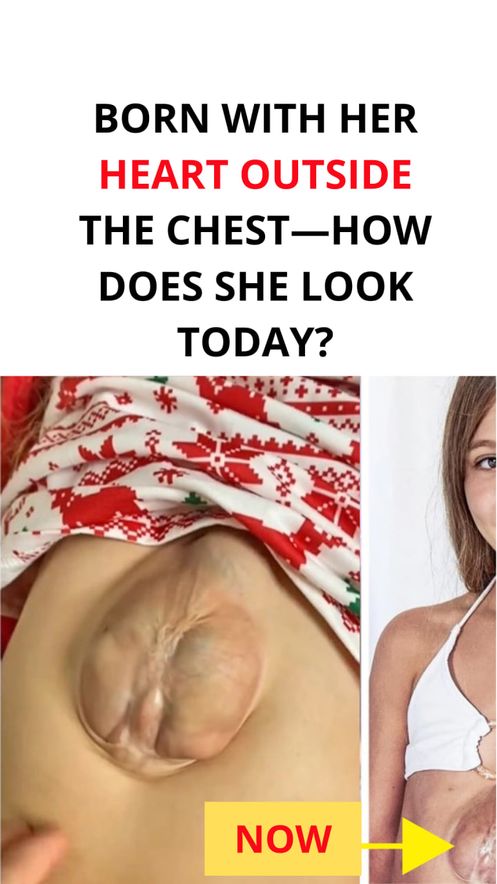 Born With Heart Outside Chest, This Baby Girl Defied Doctors And Survived Against All Odds