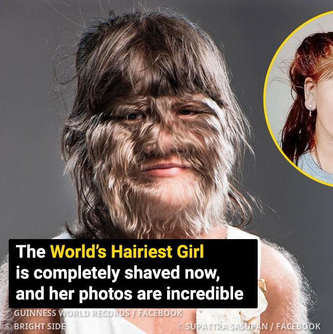 The World’s Hairiest Girl Is Completely Shaved, and She Looks Unrecognizable Now