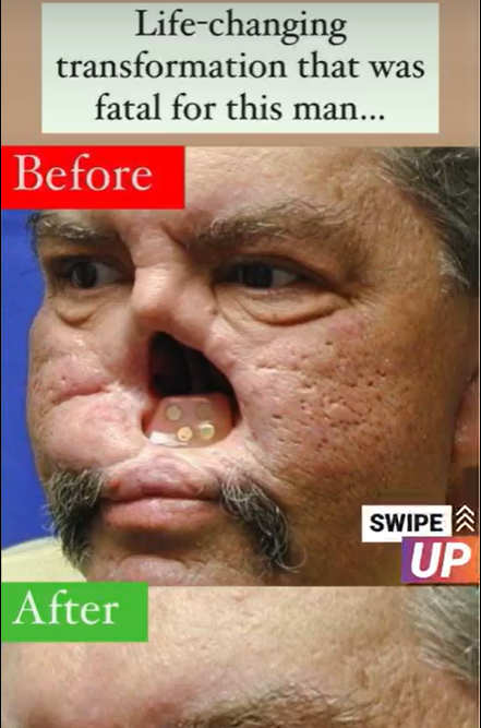 Life-changing transformation that was fatal for this man… Know more below…