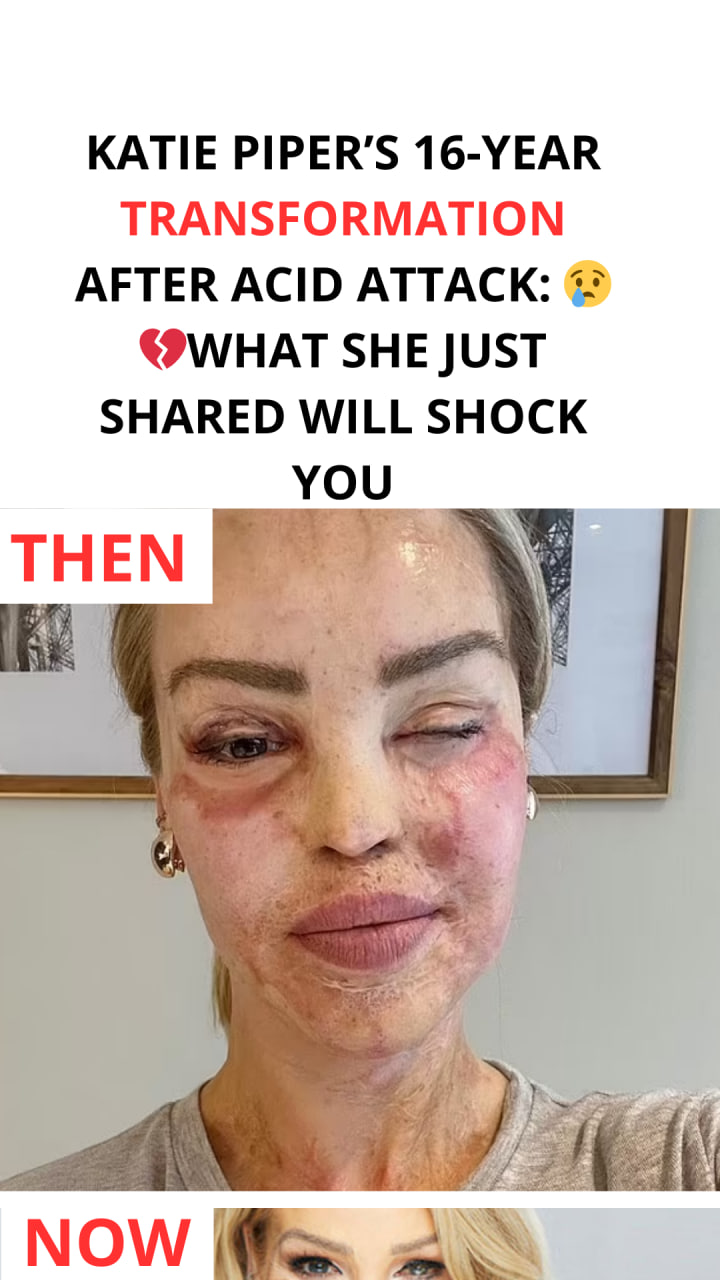 Katie Piper Shares Uplifting Update 16 Years After Overcoming Acid Attack