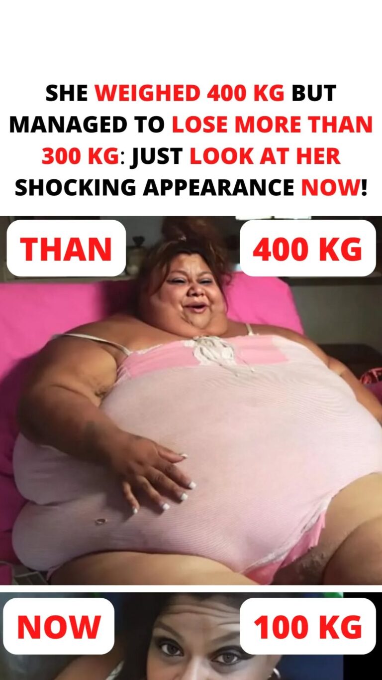 Despite weighing 400 kg, she was able to shed over 300 kg. Now just take a look at her startling appearance!