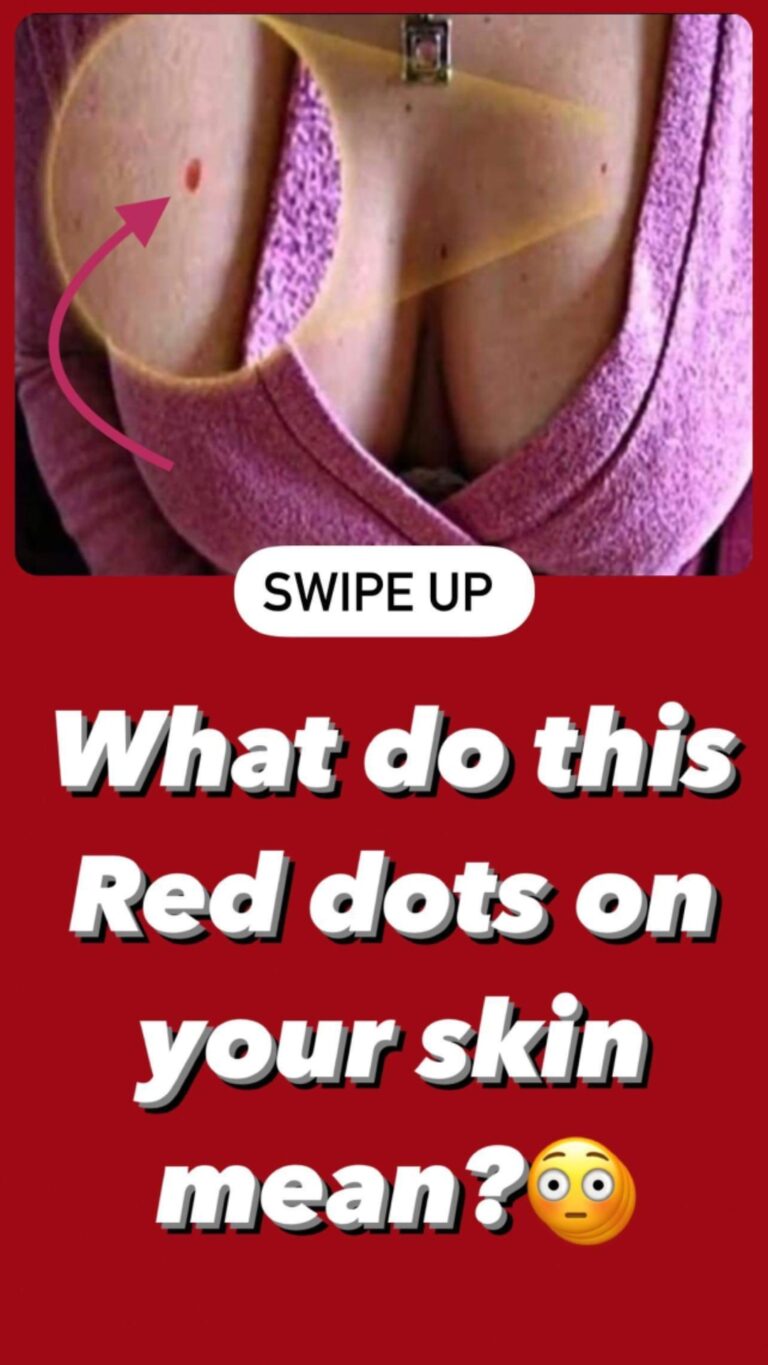 Red dots on your skin: Causes and what they could mean