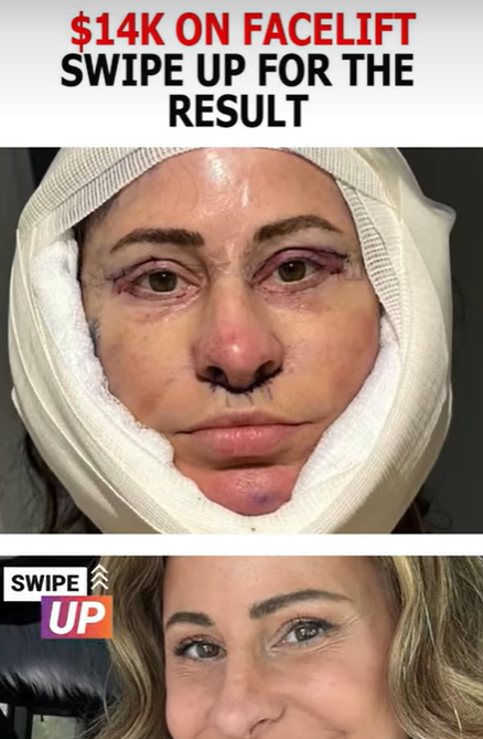 Woman Spends $14K on Facelift, Sells Home, and Embraces Van Life After Stunning Transformation!